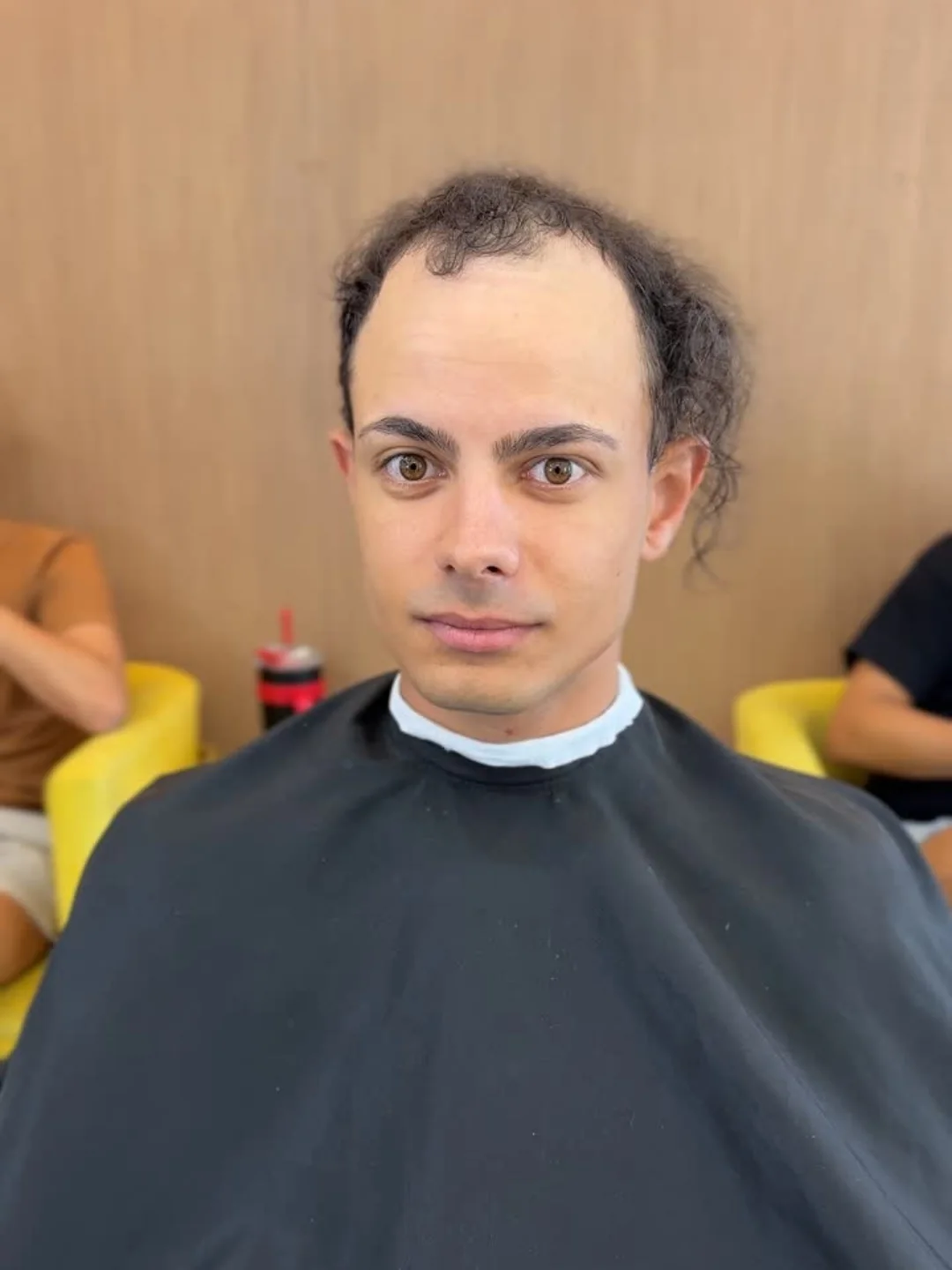 Cliente 04 antes da aplicação da prótese capilar