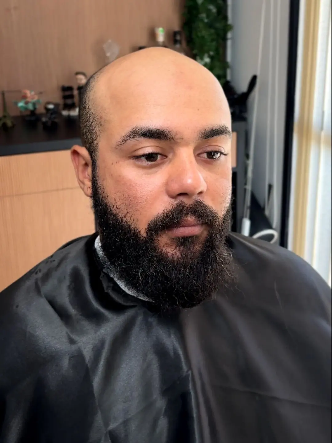 Cliente 03 antes da aplicação da prótese capilar